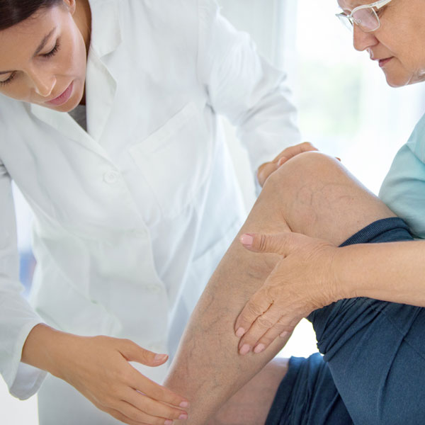 Doctor examining veins on woman's calf in Louisville, KY